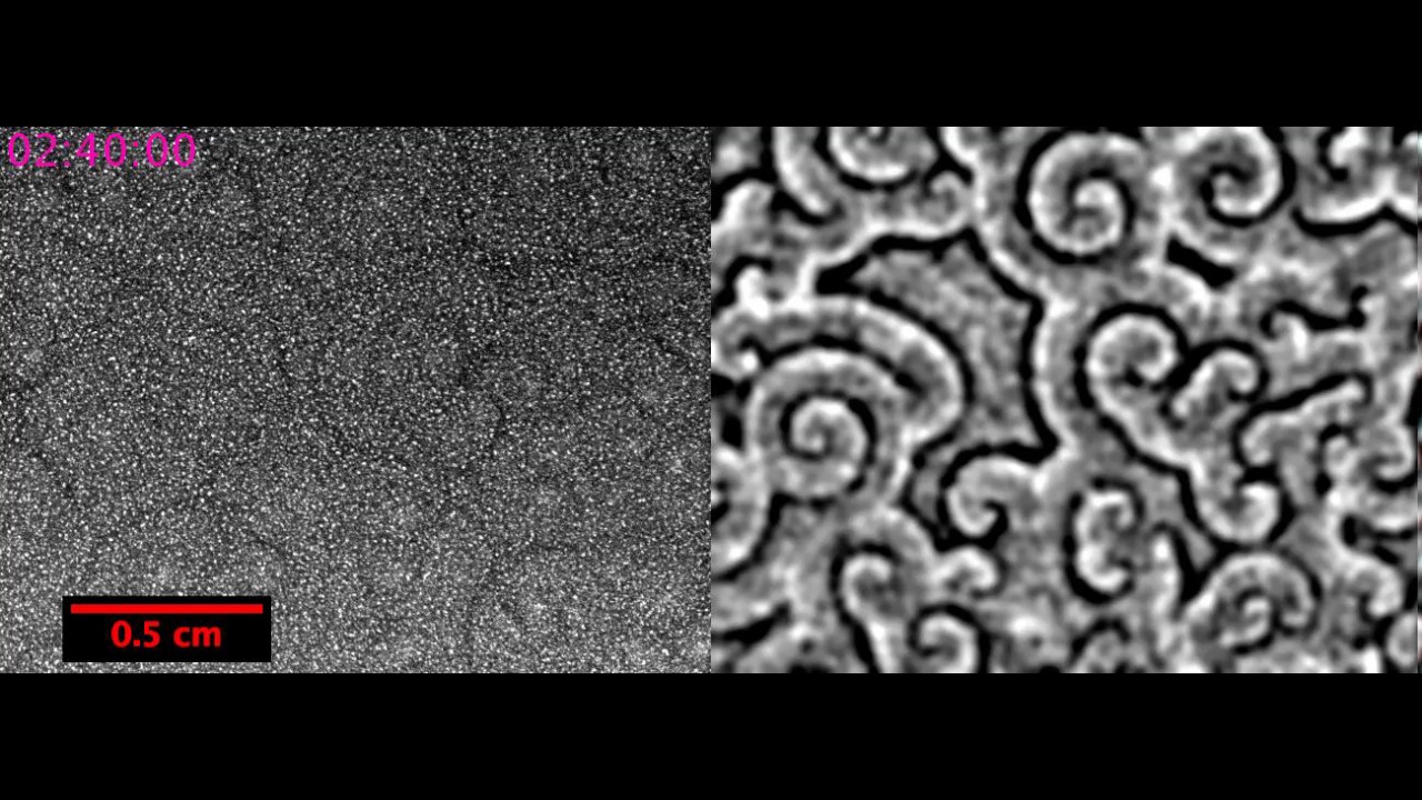 Frame from a video of spatial waves formed by aggregating Dictyostelium discoideum.