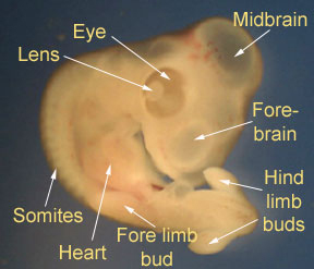 https://www.swarthmore.edu/NatSci/sgilber1/DB_lab/Chick/Chick_web_pages/Lauren_Fety/chick_web.htmlA stage 26 chick foetus